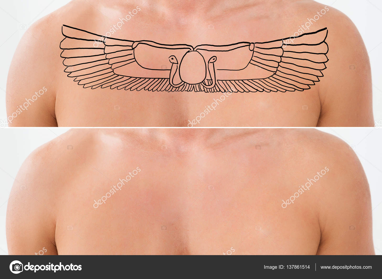 Laser Tattoo Removal Stock Photo By AndreyPopov 137861514 laser-tattoo-removal-stock-photo-by-andreypopov-137861514