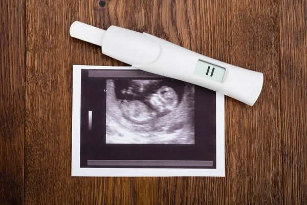 Kit de gravidez na mesa de madeira — Fotografia de Stock