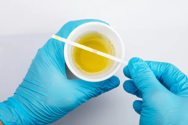 Test delle urine mediche — Foto Stock