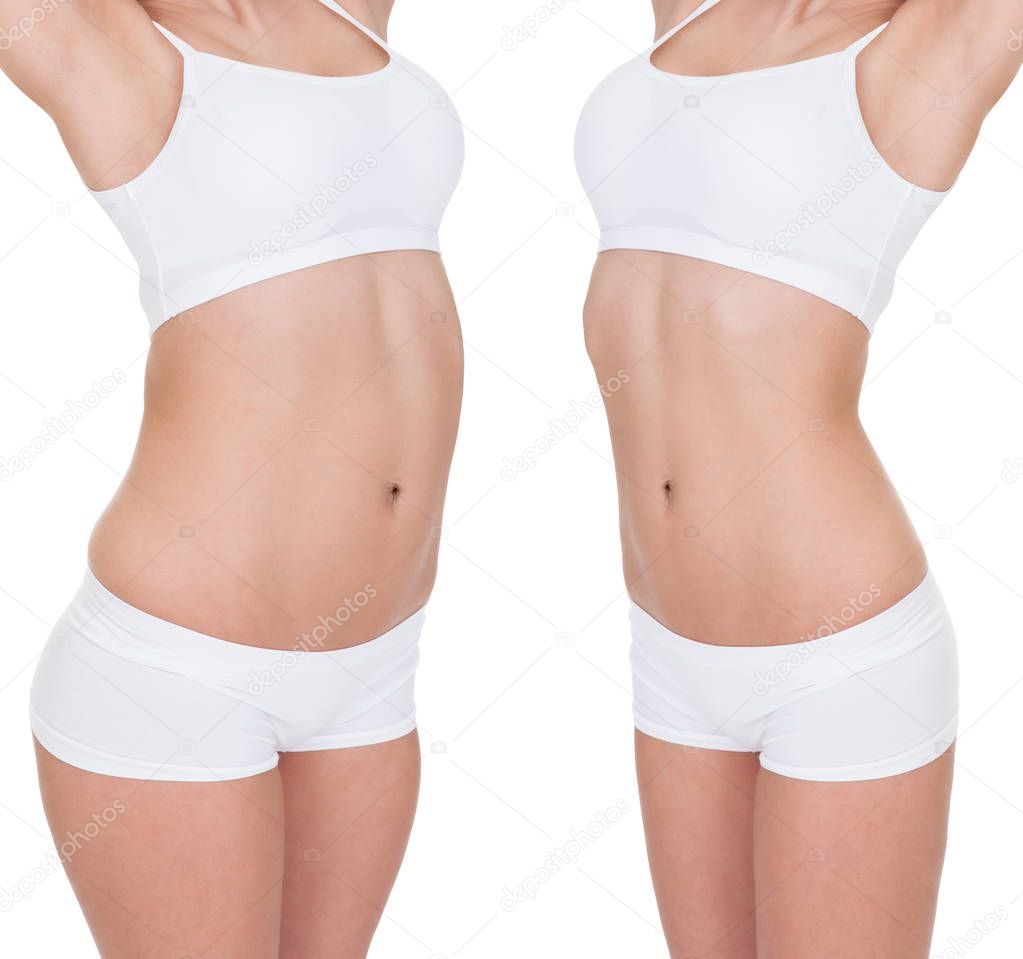 Woman Before And After Weight Loss