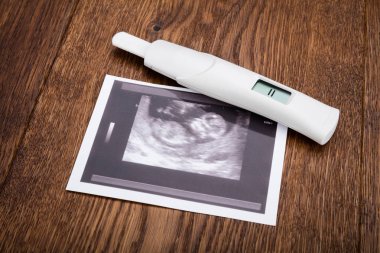 Hamilelik testi ultrason ile