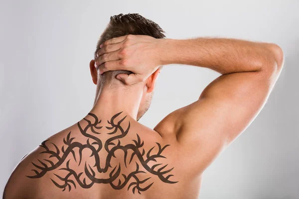 Eliminación de tatuajes láser — Foto de Stock