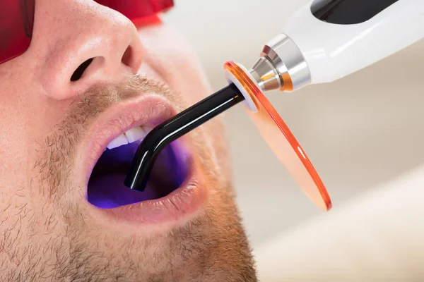 Hombre dientes tratados con UV dental —  Fotos de Stock