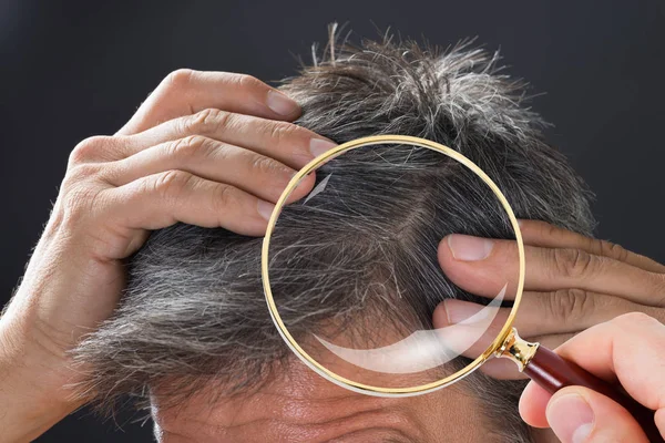 Дерматолог проверяет волосы пациента — стоковое фото