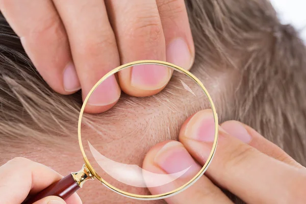 Dermatologista Verificando o cabelo do paciente — Fotografia de Stock