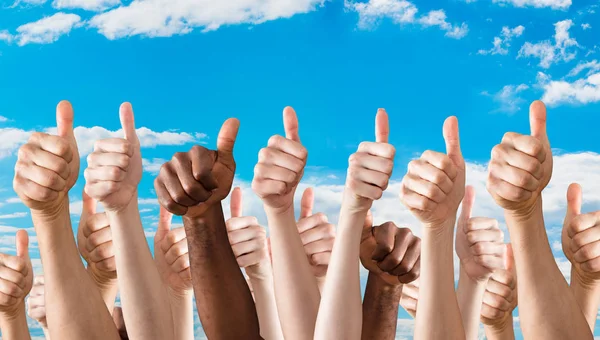 Hands Showing Thumbs Up — Stock Photo, Image