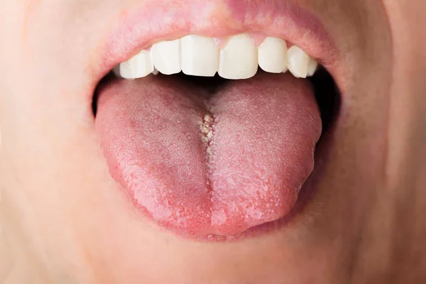 Hombre mostrando lengua — Foto de Stock
