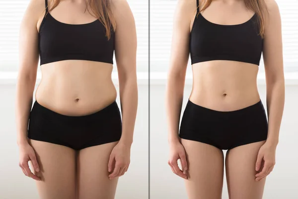 Prima e dopo la dieta — Foto Stock