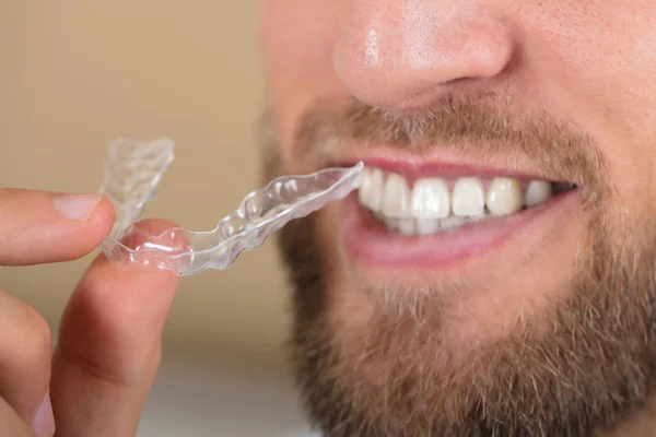 Homem segurando alinhador transparente — Fotografia de Stock