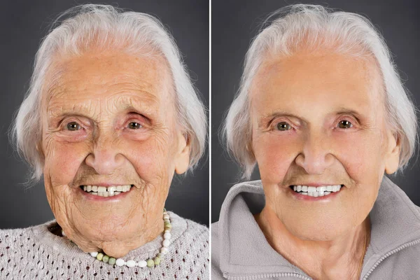 Senior Woman Aging Skin Treatment — Stock Photo, Image