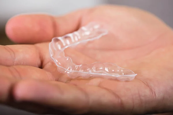 Man Holding Transparent Aligner — Stock Photo, Image