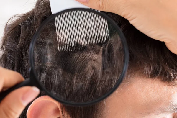 Dermatólogo revisando el cabello del paciente — Foto de Stock