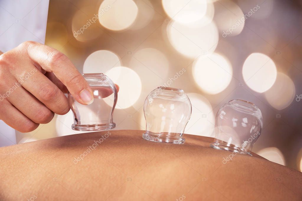 Person Receiving Cupping Treatment 