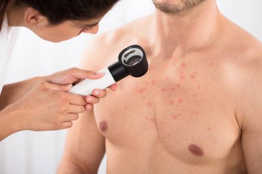 Dermatolog Acnes kontrol 