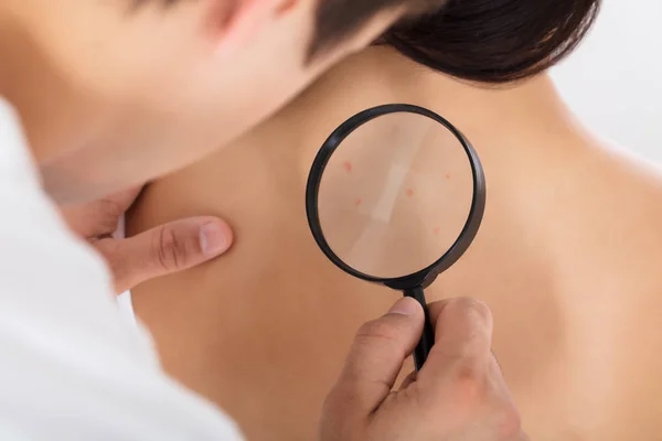 Doctor Checking Skin Of Patient — Stock Photo, Image