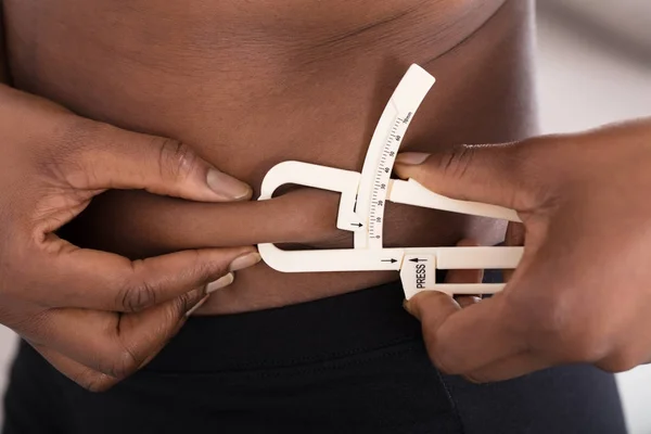 Emberi kéz gyomor Fat-val mérőkörzők mérés — Stock Fotó