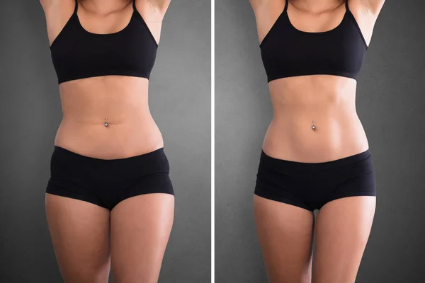 Before And After Diet — Stock Photo, Image