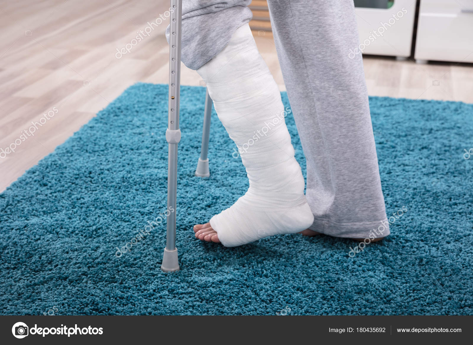 22 726 Broken Leg Stock Photos Free Royalty Free Broken Leg Images Depositphotos