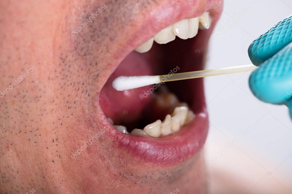 Close-up Of Dentist Hand Making Saliva Test On The Mouth With Cotton Swab