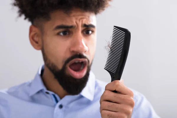 Young Man Holding Comb Looking Hair Loss — Stock Photo, Image