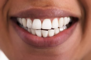 Mutlu sağlıklı dişler beyaz kadınla Close-Up