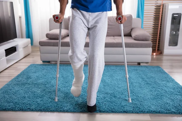 Blick Auf Das Eingegipste Bein Eines Mannes Auf Blauem Teppich — Stockfoto