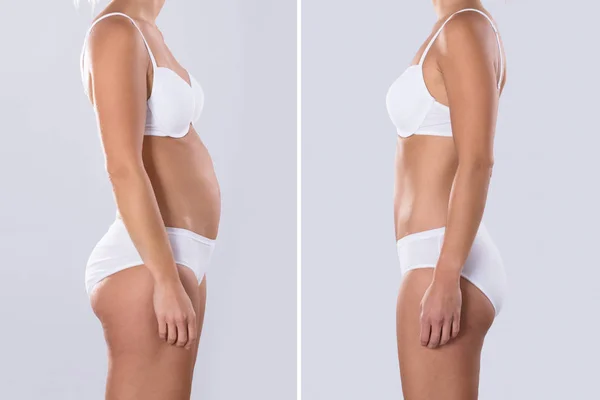 Mulher Antes Depois Dieta Formas Corpo Foram Retocadas — Fotografia de Stock