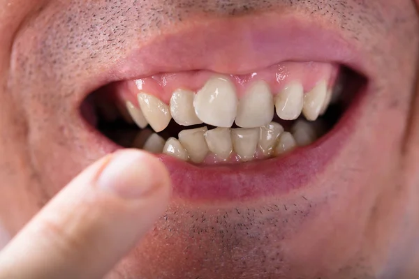 Close Homem Mostrando Seus Dentes — Fotografia de Stock