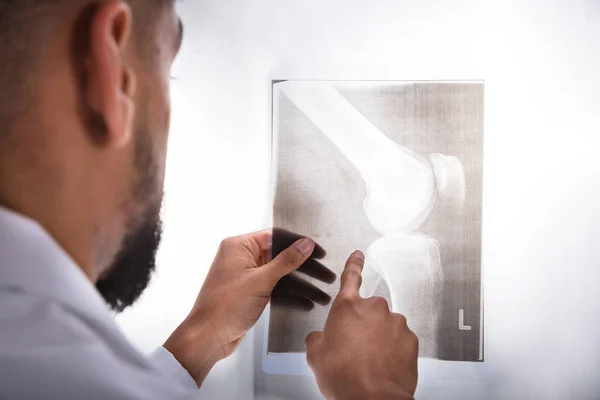 Gros Plan Jeune Médecin Examinant Une Radiographie Genou — Photo