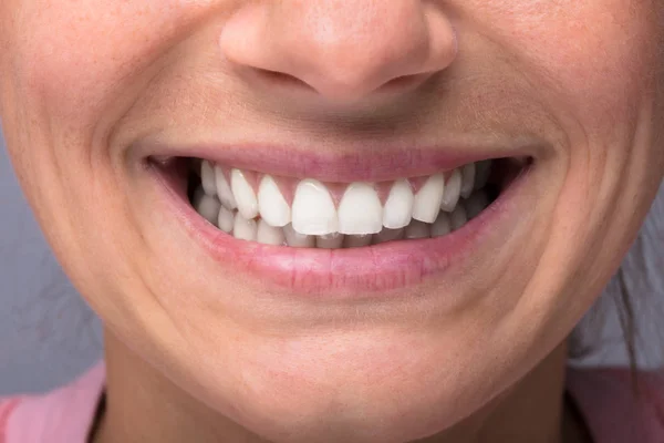 Mutlu Kadın Sağlıklı Beyaz Ile Gülümseyen Yakın Çekim — Stok fotoğraf
