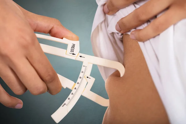 Close Mão Uma Mulher Verificando Gordura Estomacal Com Calibrador — Fotografia de Stock