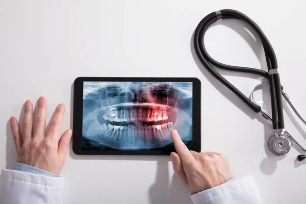 Doctor Hand Digital Tablet Screen Showing Teeth Ray Stethoscope White — Stock Photo, Image