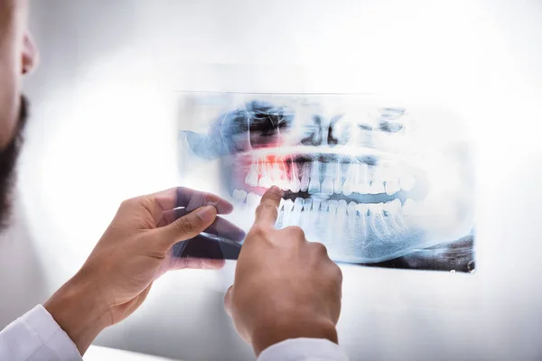 Рентген Зубов Крупным Планом Стоматолога — стоковое фото