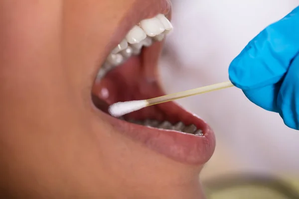 Zbliżenie Ręki Stomatologa Badanie Śliny Jamie Ustnej Wacikiem — Zdjęcie stockowe