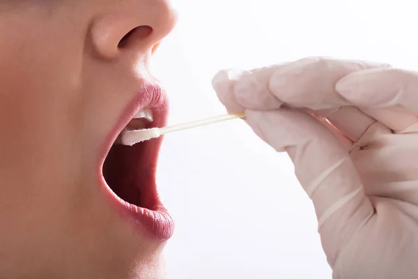 Mão Dentista Tomando Teste Saliva Boca Mulher Com Algodão Swab — Fotografia de Stock