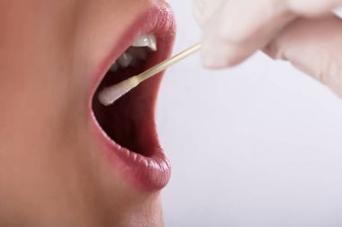 Dişçi el ile pamuklu çubukla kadın ağzından tükürük testi alarak