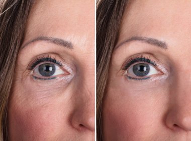Anti-Aging yordamlar Kafkas kadın yüzündeki fotoğrafı
