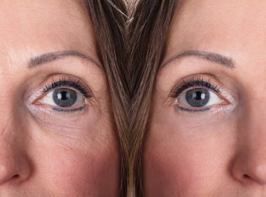 Anti-Aging yordamlar Kafkas kadın yüzündeki fotoğrafı
