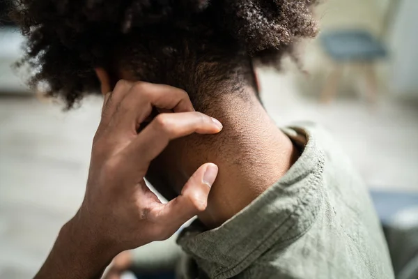 Close Woman Hand Scratching His Neck 