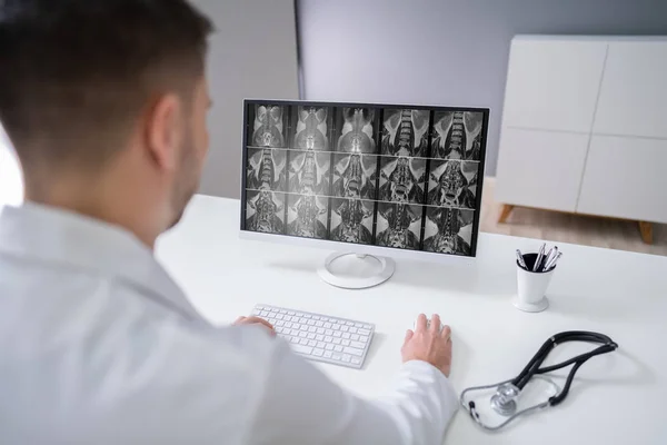 Volwassen Mannelijke Arts Onderzoekt Wervelkolom Ray Kliniek — Stockfoto