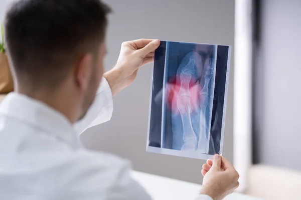 Close Mão Médico Masculino Segurando Raios — Fotografia de Stock