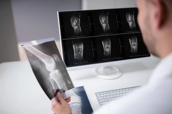 Médico Masculino Maduro Examinando Radiografía Rodilla Clínica —  Fotos de Stock