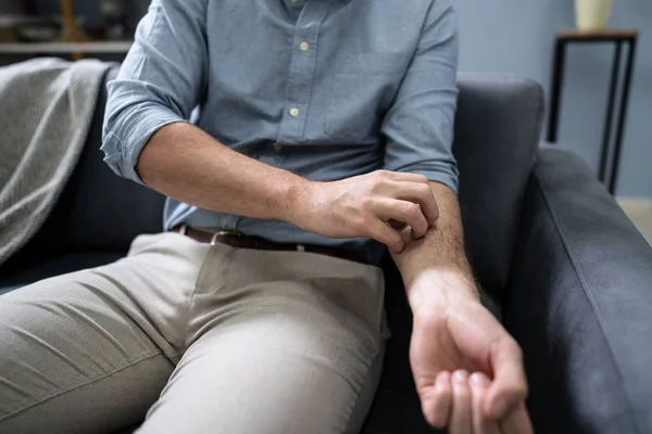 Primer Plano Hombre Africano Rascándose Mano — Foto de Stock