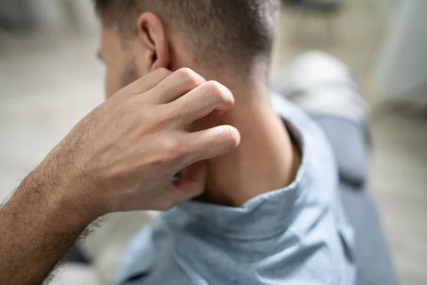 Close Man Hand Scratching Itch His Neck — Stock Photo, Image