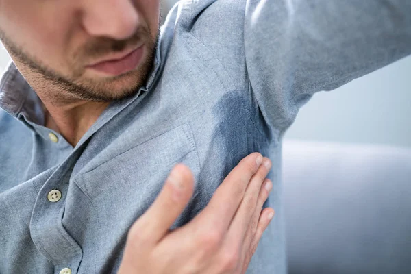 Hombre Con Hiperhidrosis Sudando Muy Mal Debajo Axila —  Fotos de Stock