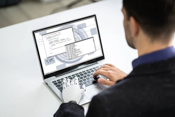 Homem Com Mão Protética Trabalhando Laptop Membro Artificial — Fotografia de Stock