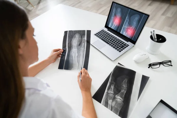 Médico Femenino Examinando Radiografía Rodilla Ordenador Portátil Clínica — Foto de Stock