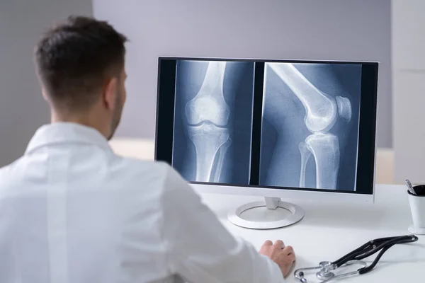 Médico Masculino Maduro Examinando Radiografía Rodilla Clínica — Foto de Stock