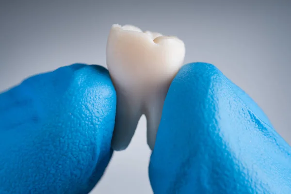 歯を保持手袋で歯医者の手のクローズアップ — ストック写真
