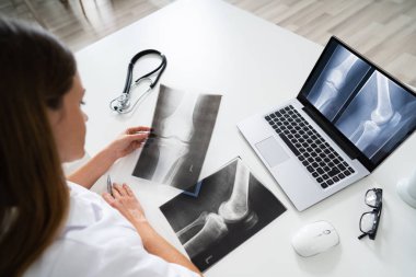 Stetoskop ile Laptop On Foot X-Ray Looking 